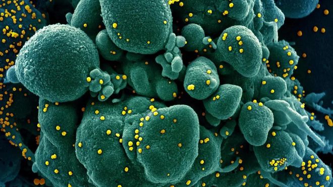Este es el grupo sanguíneo más propenso a padecer coronavirus, según un estudio Este es el grupo sanguíneo más propenso a padecer coronavirus, según un estudio