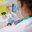 Archivo - Una técnico de laboratorio prepara una PCR para el análisis de la viruela del mono en una imagen de archivo