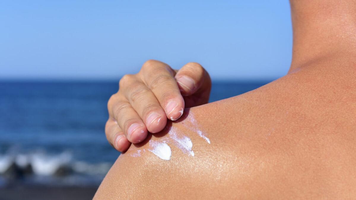 7 trucos infalibles para proteger tu piel de sol si tienes manchas