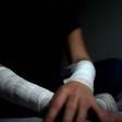 Las autolesiones entre los adolescentes y los jóvenes se han convertido en un problema de salud pública. /