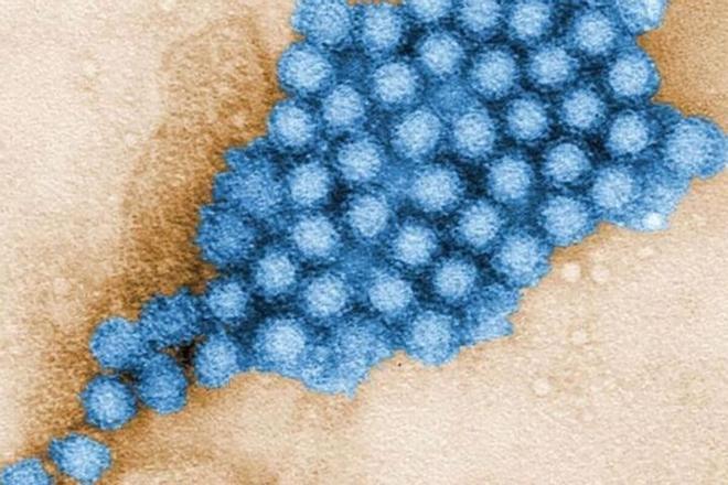 Qué es el contagioso norovirus que ha provocado un brote de 142 casos en Almería