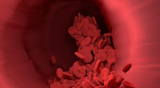 «Síndrome de la sangre pegajosa»: Causas, síntomas, tratamiento «Síndrome de la sangre pegajosa»: Causas, síntomas, tratamiento