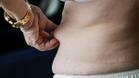 ¿Mayor de 65 años? Casi seguro, con obesidad abdominal: ¿Qué se puede hacer?