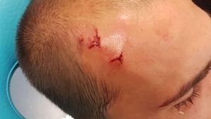 Bas Dost fue agredido en el vestuario del Sporting Bas Dost fue agredido en el vestuario del Sporting