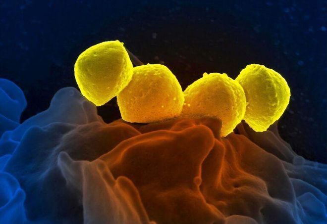 Las células humanas crean su propio «detergente» contra las infecciones Las células humanas crean su propio «detergente» contra las infecciones