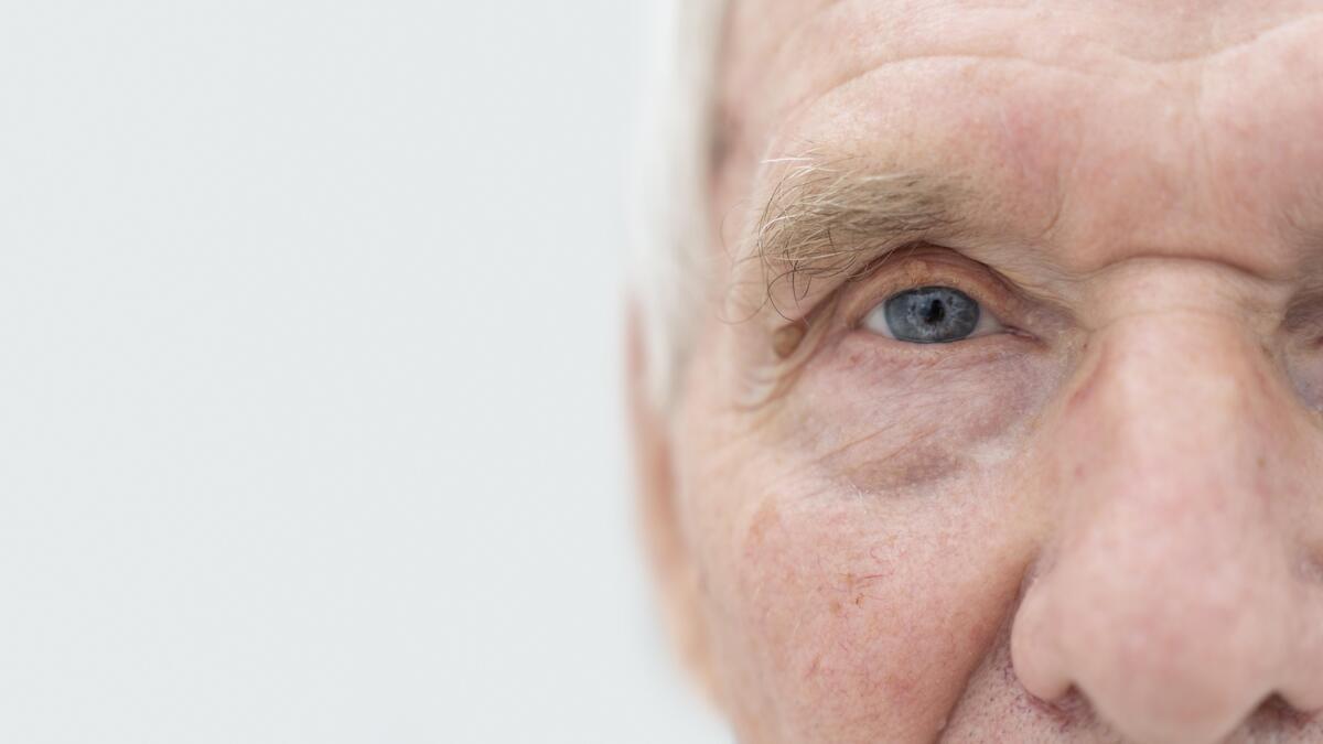 Ojo seco: la dolencia que se dispara en invierno y afecta a mayores de 40 años