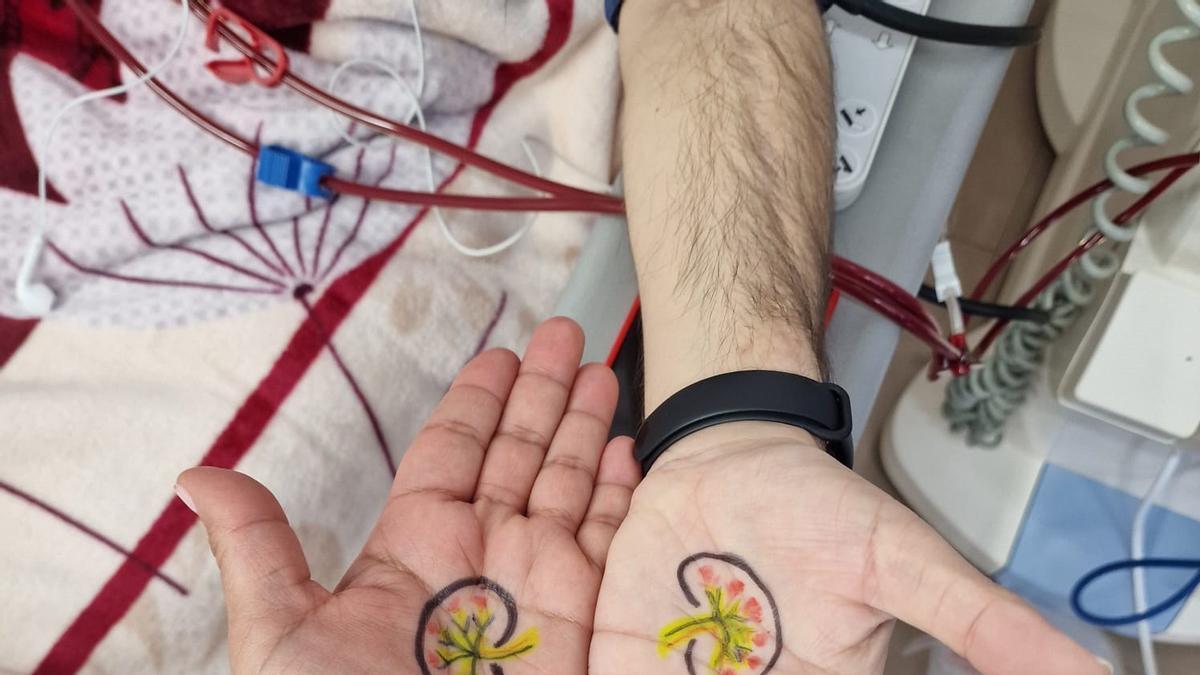 ENFERMEDADES RENAL |  Los nefrólogos piden un impulso para la diálisis en el domicilio del paciente: «Son todo ventajas»
