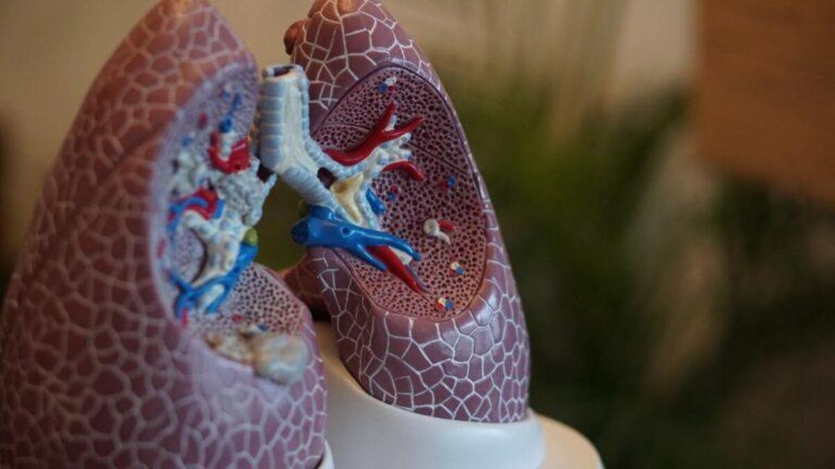 Cortistatina: la clave para revertir la fibrosis pulmonar Cortistatina: la clave para revertir la fibrosis pulmonar