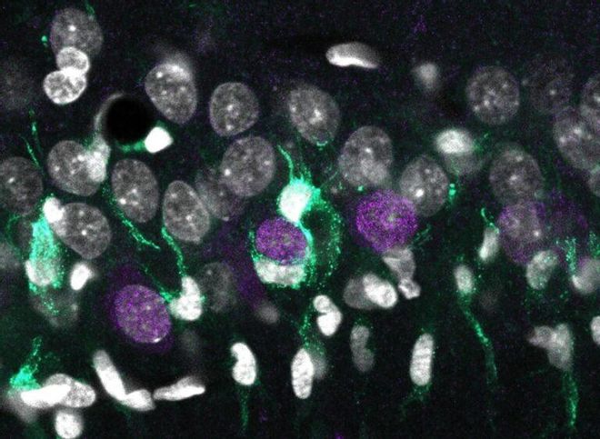 Encuentran los genes que explican la muerte neuronal en la epilepsia Encuentran los genes que explican la muerte neuronal en la epilepsia
