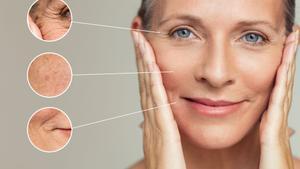 Signos de la menopausia en la piel.