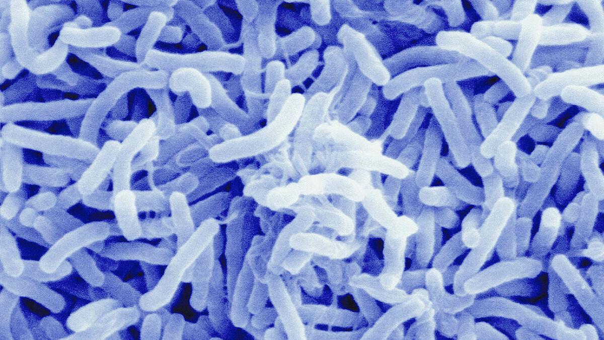 ¿Qué es la cólera? La enfermedad que ha vuelto a aparecer en España después de 43 años