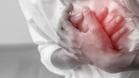 ¿Qué es un infarto agudo de miocardio? ¿cómo prevenirlo?