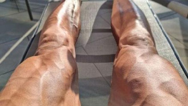 Ibrahimovic sorprende con su físico después de su operación de rodilla