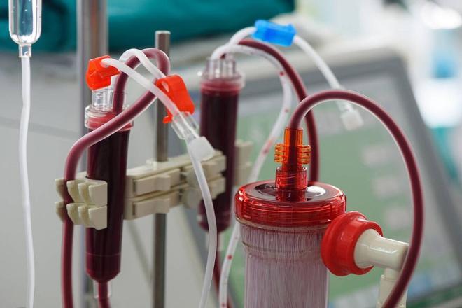 Lavado de sangre contra la COVID-19: qué es y por qué es contraproducente
