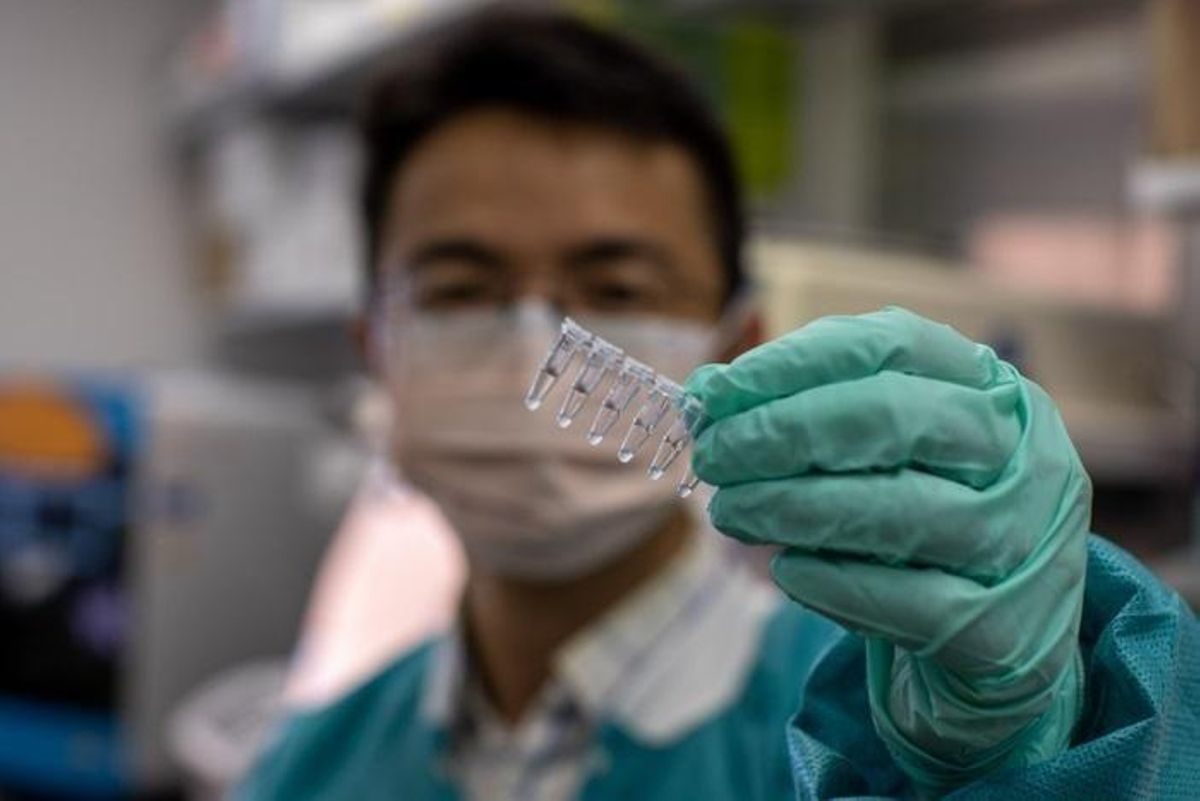 Archivo - Muestras preparadas con el agente quelante que preserva el ARN del SARS-CoV-2 para su detección por PCR Archivo - Muestras preparadas con el agente quelante que preserva el ARN del SARS-CoV-2 para su detección por PCR