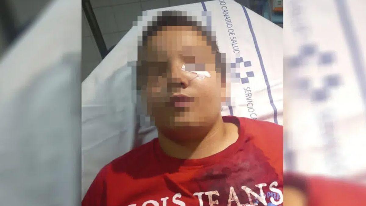 Un niño de 11 años de Canarias acaba hospitalizado tras defender a su abuelo.